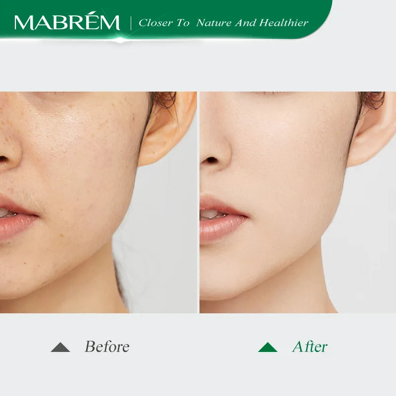 Deep Cleansing Pore Control Oil Rejuvenation Face Mask